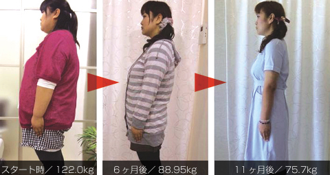 I.Sさん（25歳/身長165センチ・体重122.0kg）の場合。11ヶ月後に体重-46.3kg/体脂肪-19.1％に!